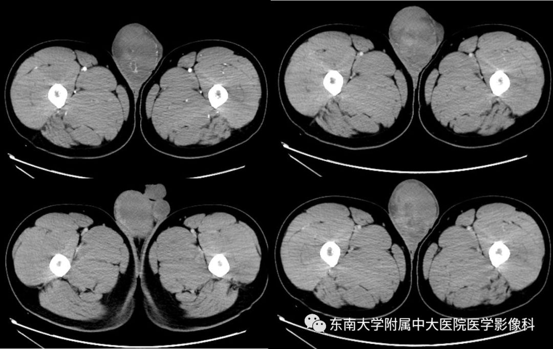 睾丸和卵巢分别是男女生殖(睾丸和卵巢既属于什么又属于什么)-第2张图片-鲸幼网