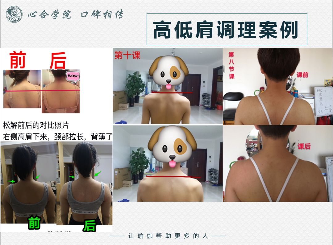 颈肩私教难不难做这套私教理疗通用方案供你直接使用