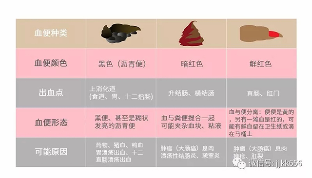 血便可能是黑色,暗红,鲜红,出血点不同则原因不同!