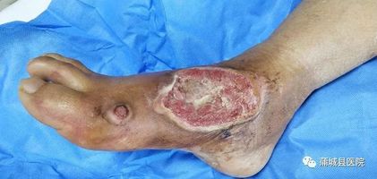 蒲医故事花开蝶自来