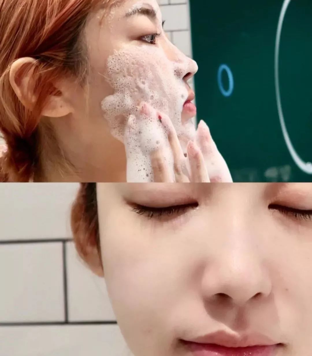 有一种整容叫"给脸除螨"!抹掉痘痘,黑头,大毛孔