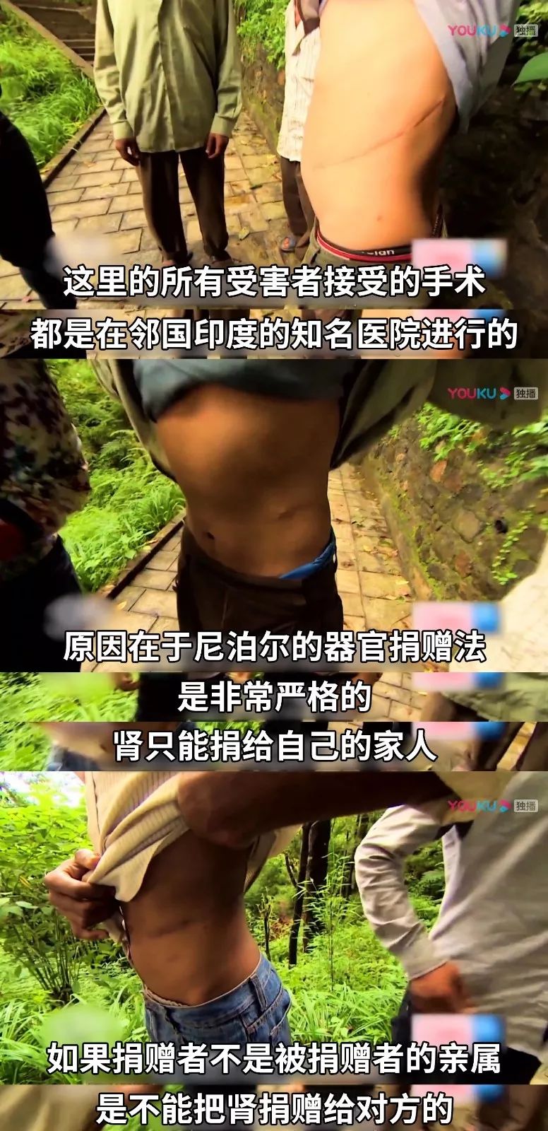 尼泊尔器官走私黑市价值百万的肾这里只要几十元