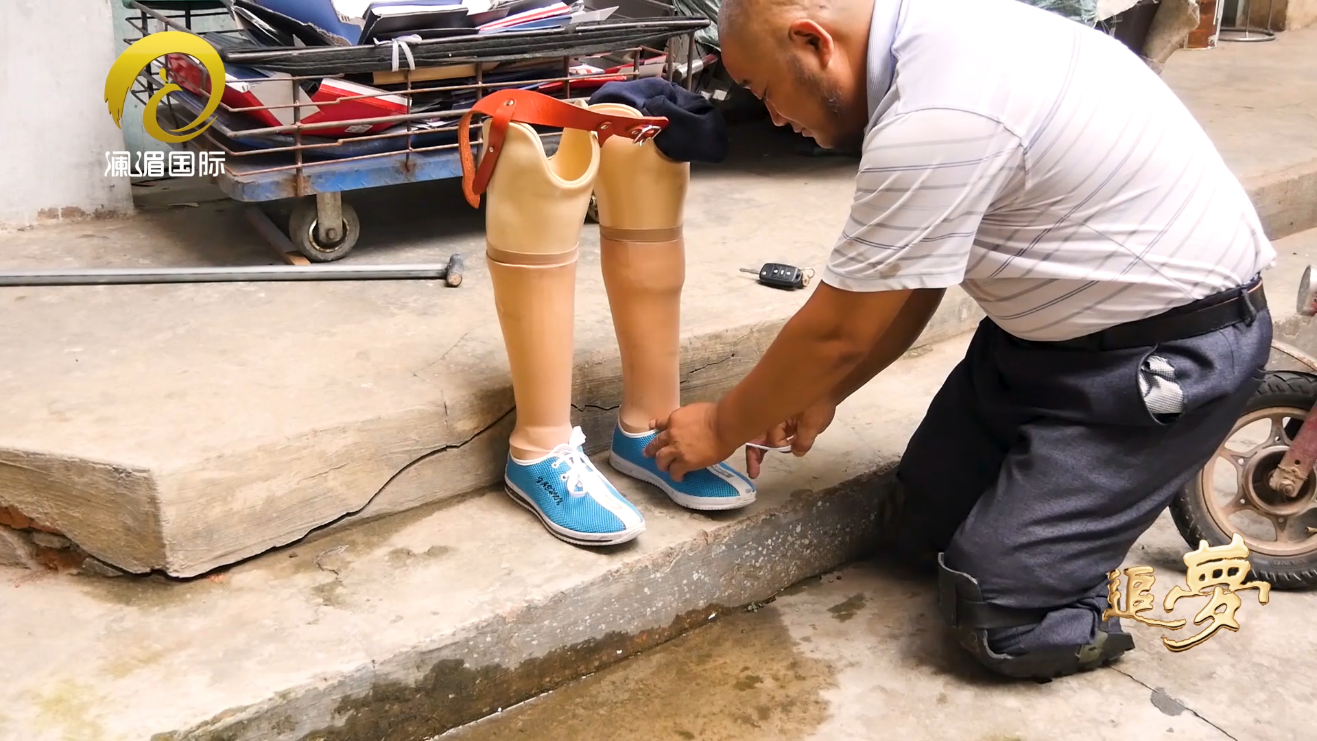 追梦|假肢装配 让生活又充满希望