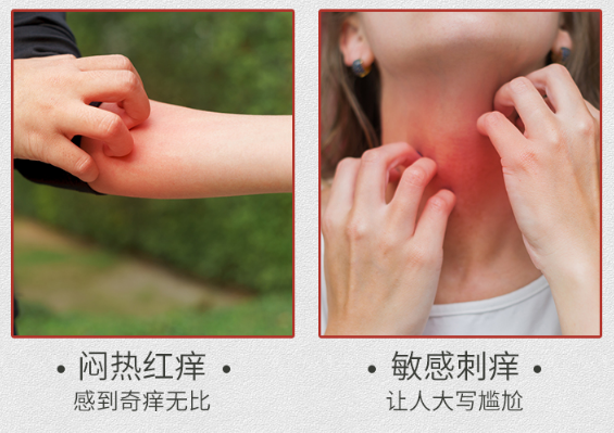 季节性湿疹两年多涂了皮清夫软膏症状明显好了