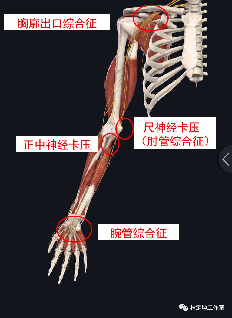 神经沿线不同区域病变导致不同疾病林主任的手再次回刘阿姨的前臂近端