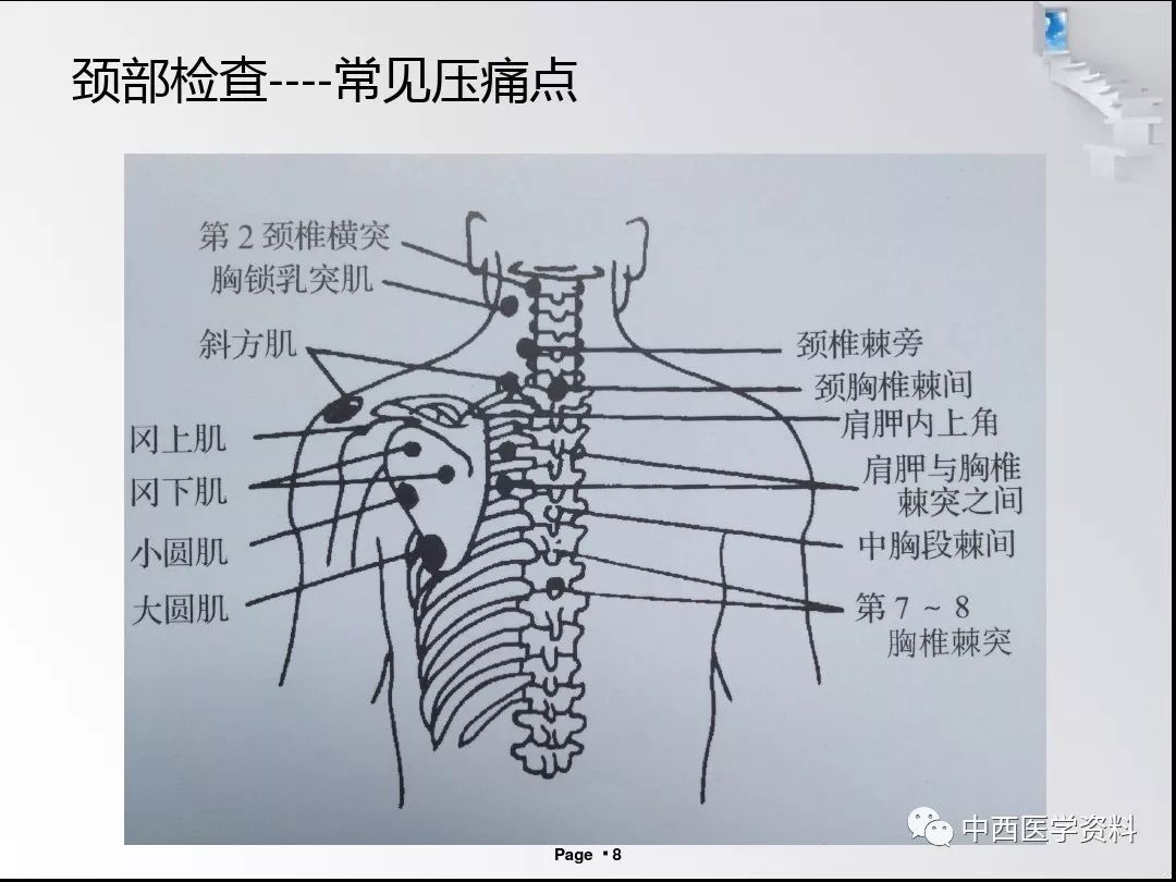 疼痛科常用体检及意义图文结合