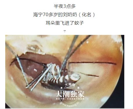 还有蟑螂▽虱子▽还有很多我们常见的飞蛾,小甲壳虫,蜈蚣.正值高发!