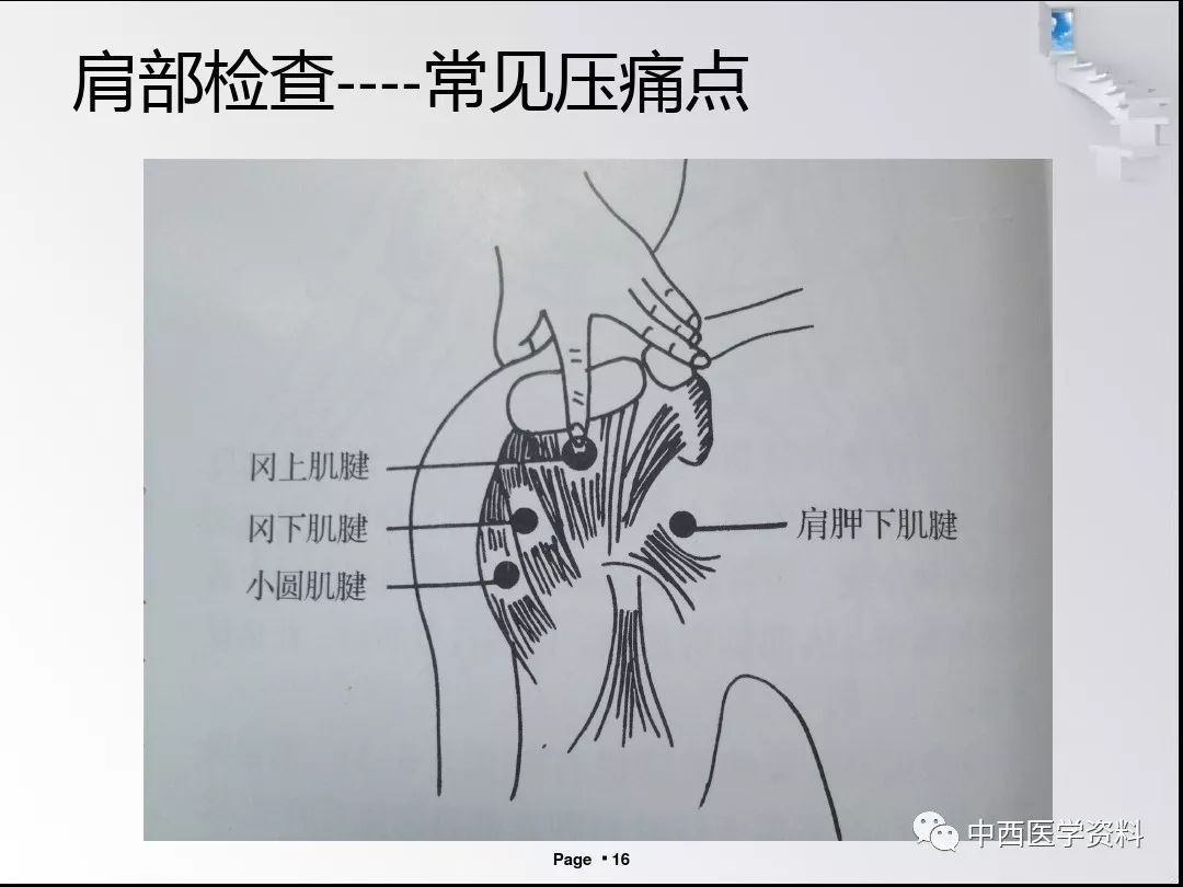 疼痛科常用体检及意义图文结合