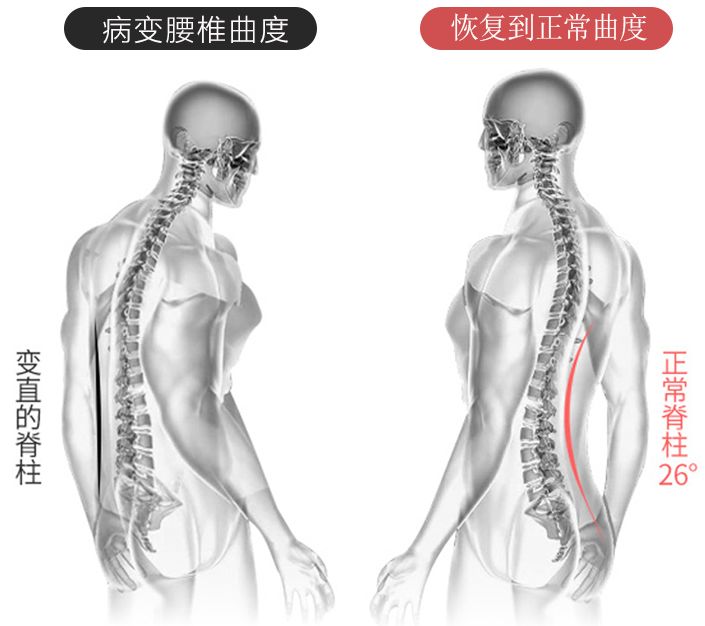 让变形的腰椎慢慢恢复到正常弧度让腰椎长期保持在一个正确的弧度上