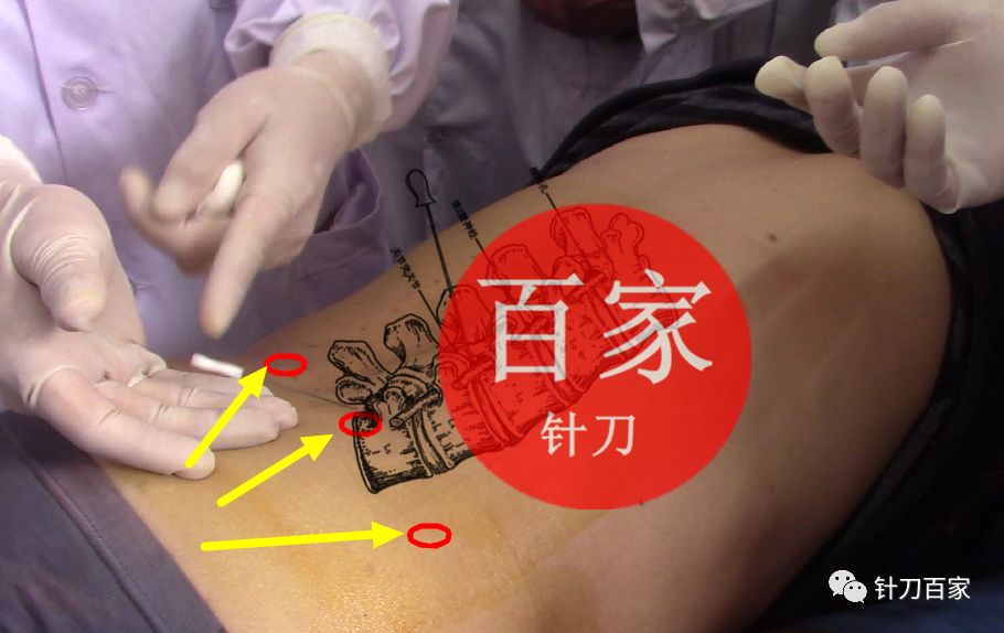 课程通知927陕西西安针刀临床解剖班927105解剖实操