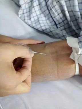 静脉输液的这些细节,你注意过吗?