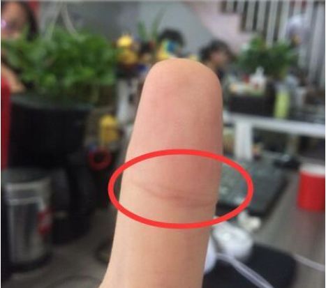 大拇指上有这个的人,男娶富妻女嫁贵夫,天生富贵命!_女人
