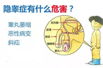 宝宝的"蛋蛋"哪儿去了?_阴囊
