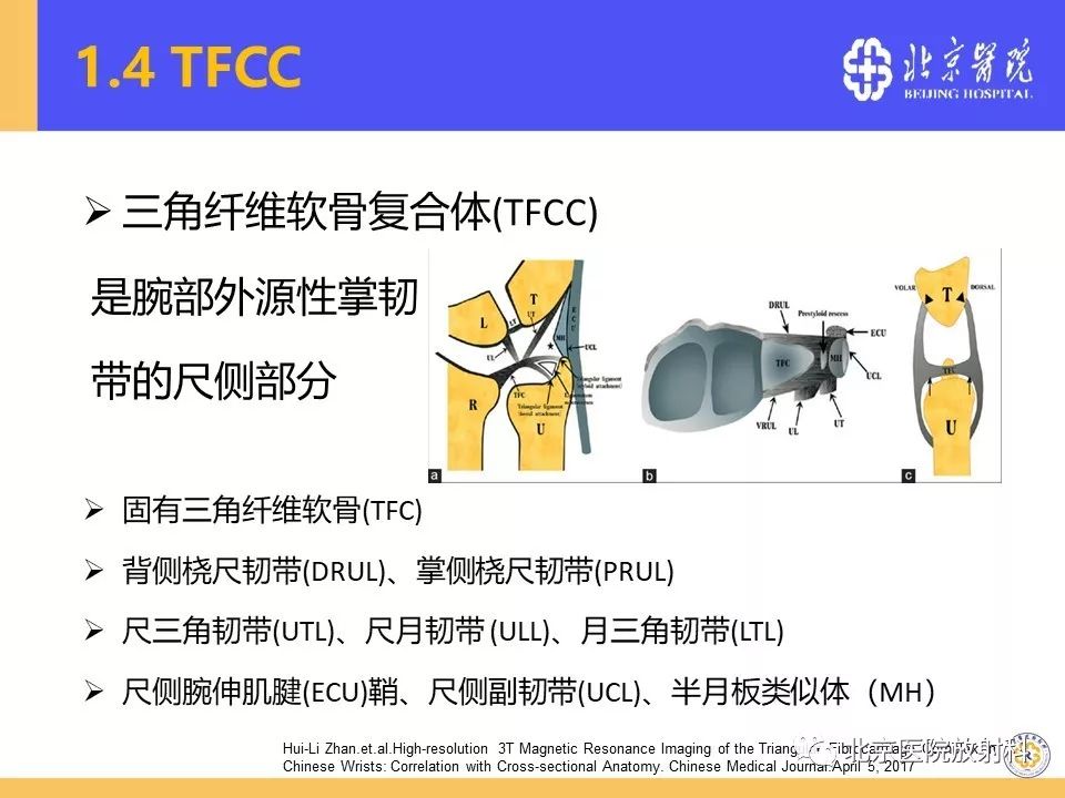 推荐| 三角纤维软骨复合体(tfcc)损伤