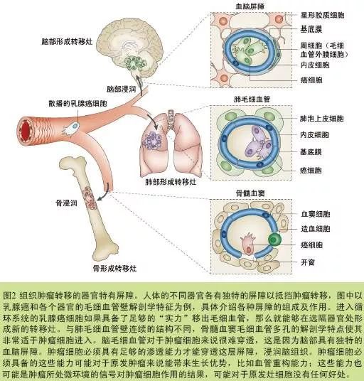 关注到底什么是癌细胞的浸润和转移