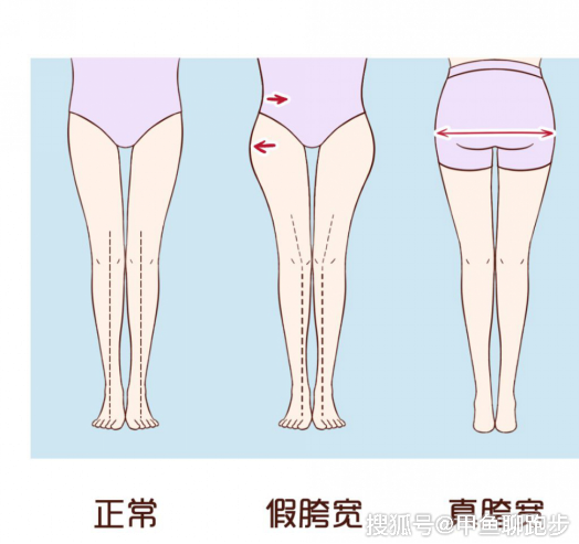 屁股鬆弛下垂的人,髖部的位置也很低,這也是造成