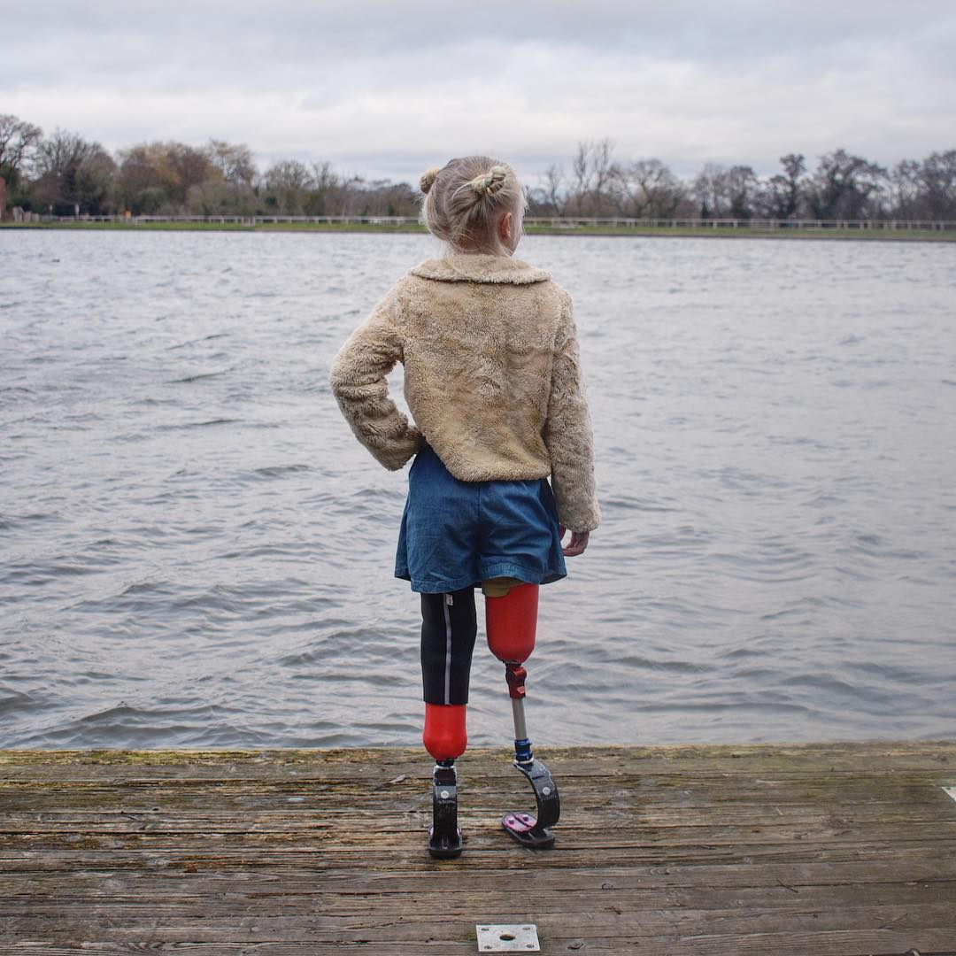 原创天生没有双腿的女孩自豪地走在国际t台上这画面真美