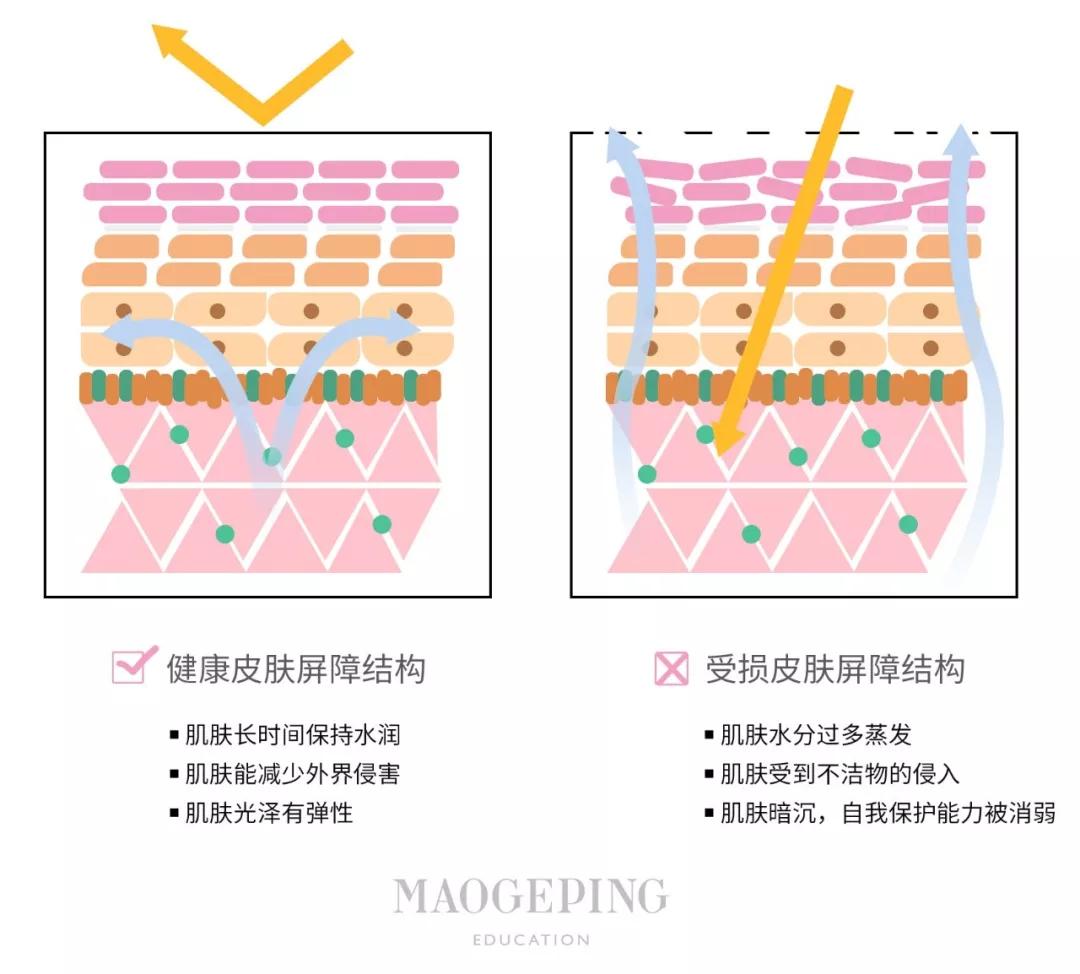 如果你常年在跟以上皮肤问题做斗争 那就要考虑你是不是皮肤屏障受损