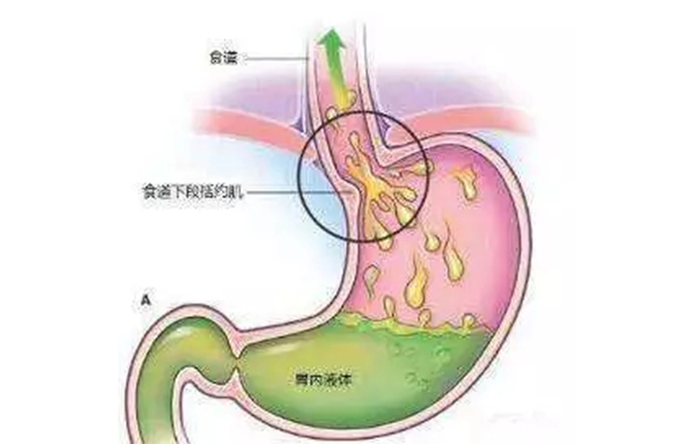 探秘温州胃肠科:医术与爱心同行
