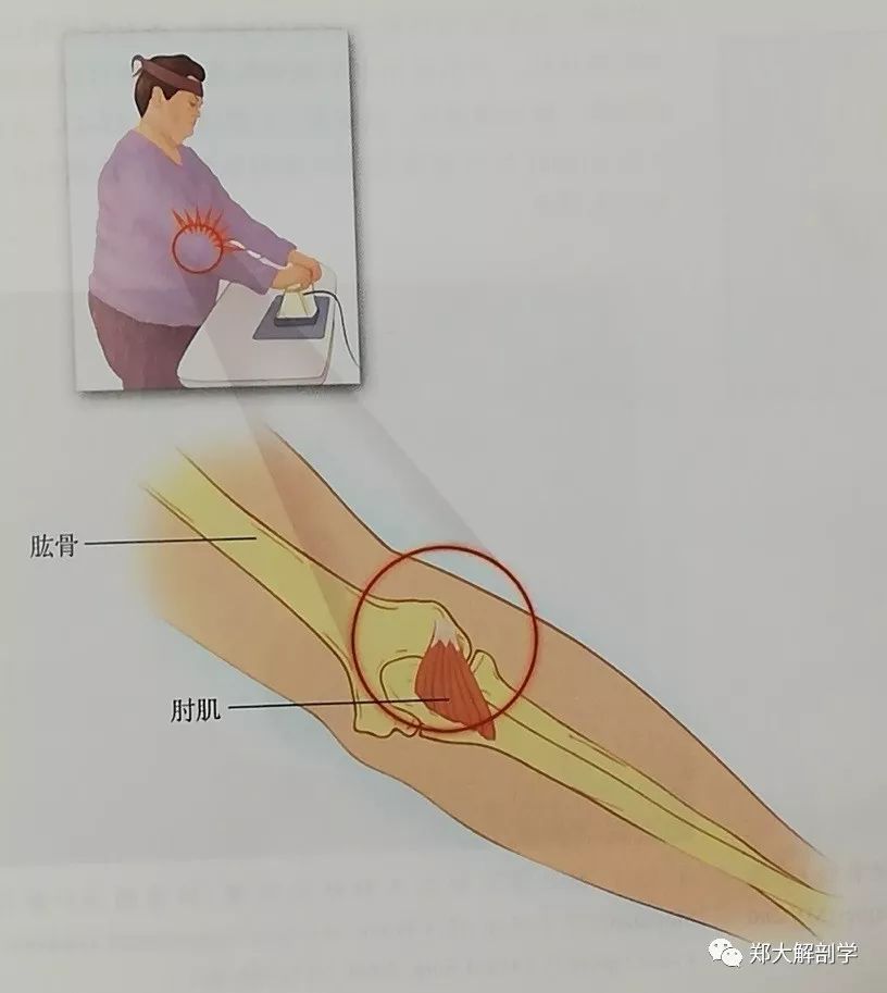 六种引起肘关节的疼痛综合征Ⅰ