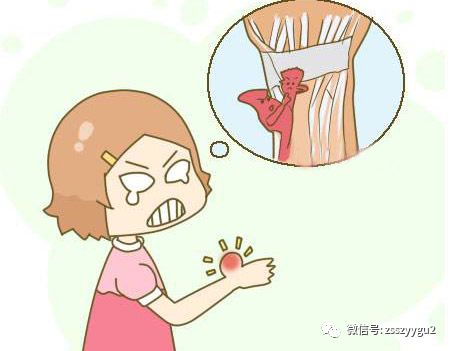 手机不离手腱鞘炎找上门