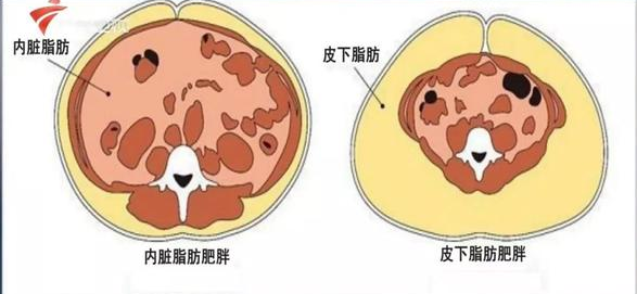 内脏脂肪和皮下脂肪图图片