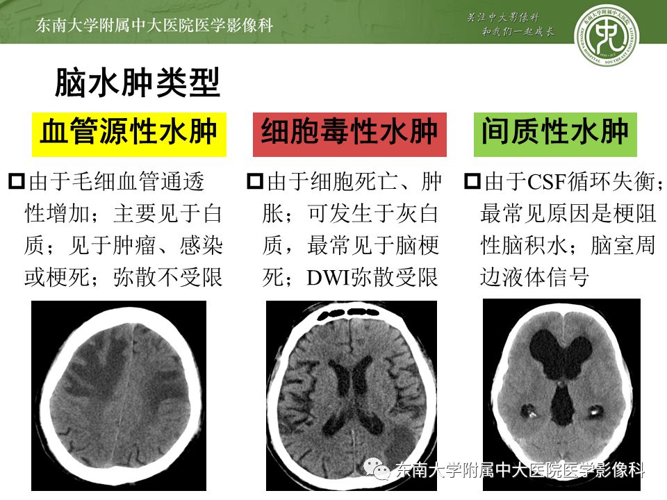 中枢神经系统病例随访