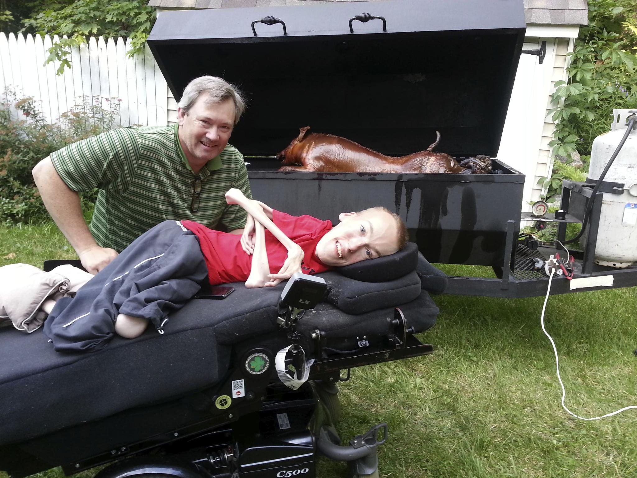 镜头下一个几乎只剩下骨头的男孩拍摄了一组震撼人心的写真照