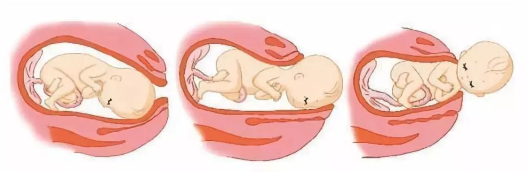 胎儿入盆五大信号孕晚期要注意这些情况的发生