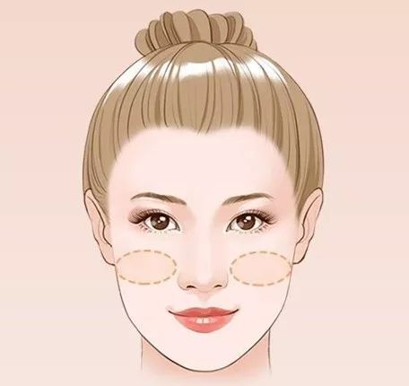 小丹颜究所面部凹陷是瘦了不那是老了