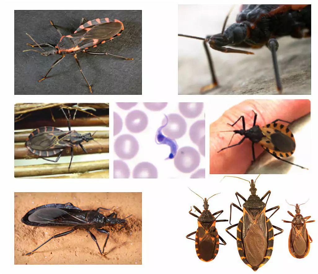 寻虫环游记第九站锥虫下美洲锥虫病