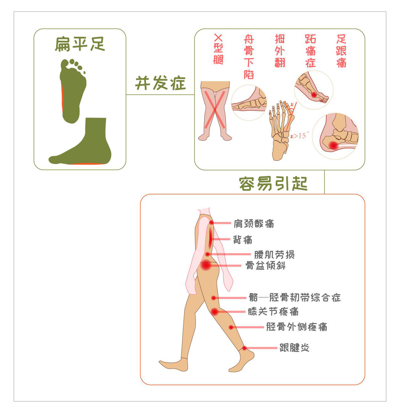 为什么要给宝宝穿功能矫健鞋