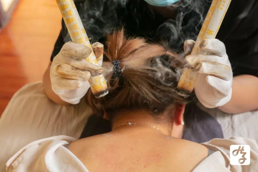 再借用灸火的热力以及药物的作用,通过经络的传导,以起到温通气血