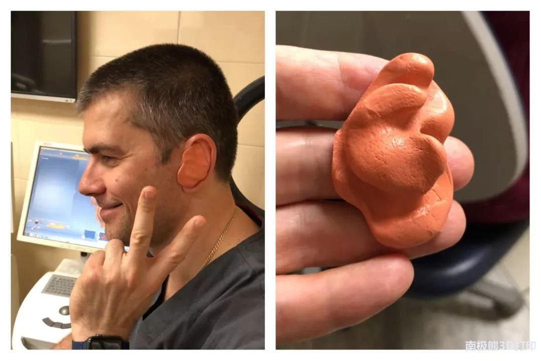 俄罗斯医生用uniz3d打印技术魔改airpods耳机