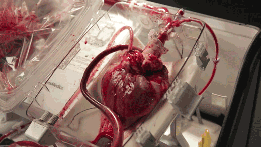 心脏血液循环图动态图图片