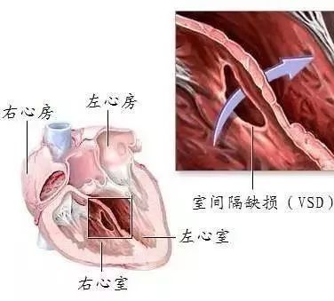 房间隔位置图片