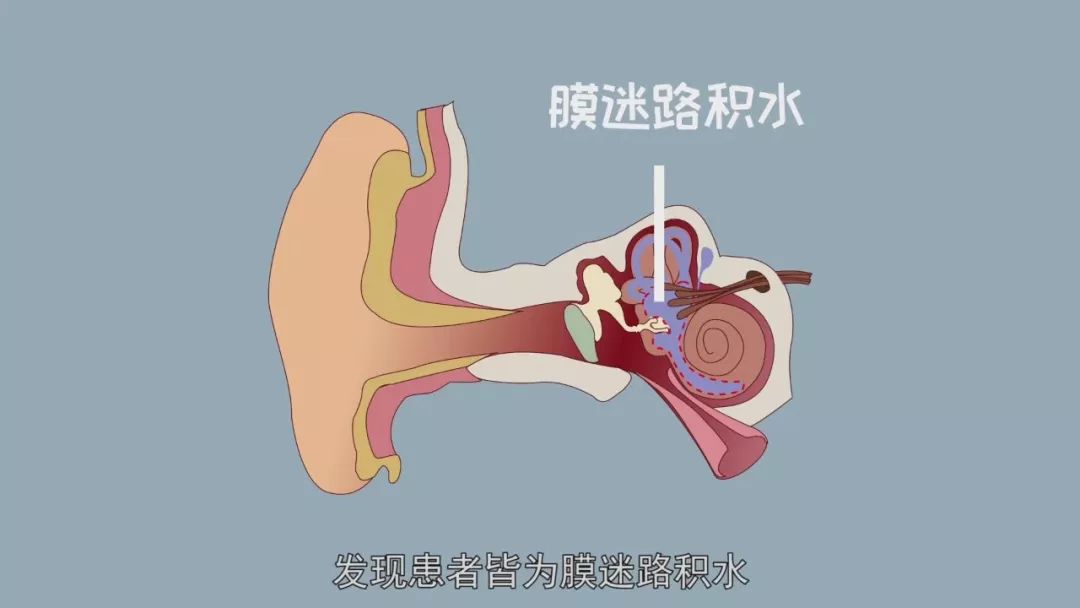 膜迷路图片