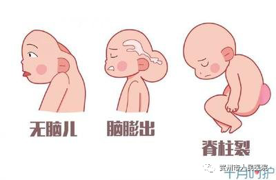 胎儿畸形卡通图片