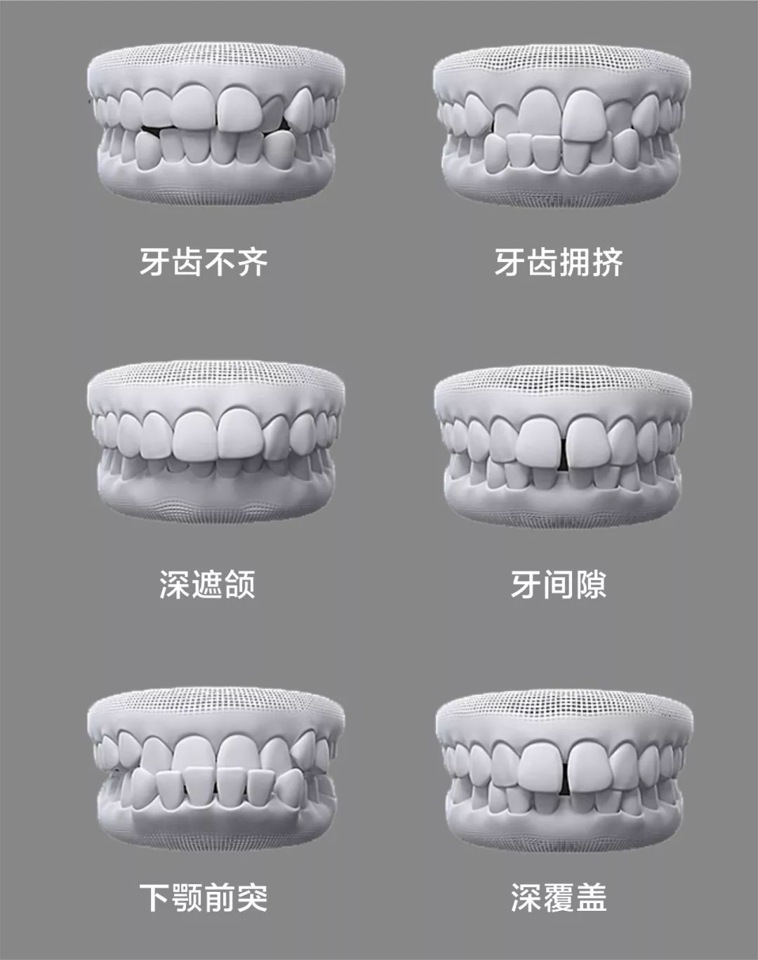 3d数字化矫正4150元!_牙齿