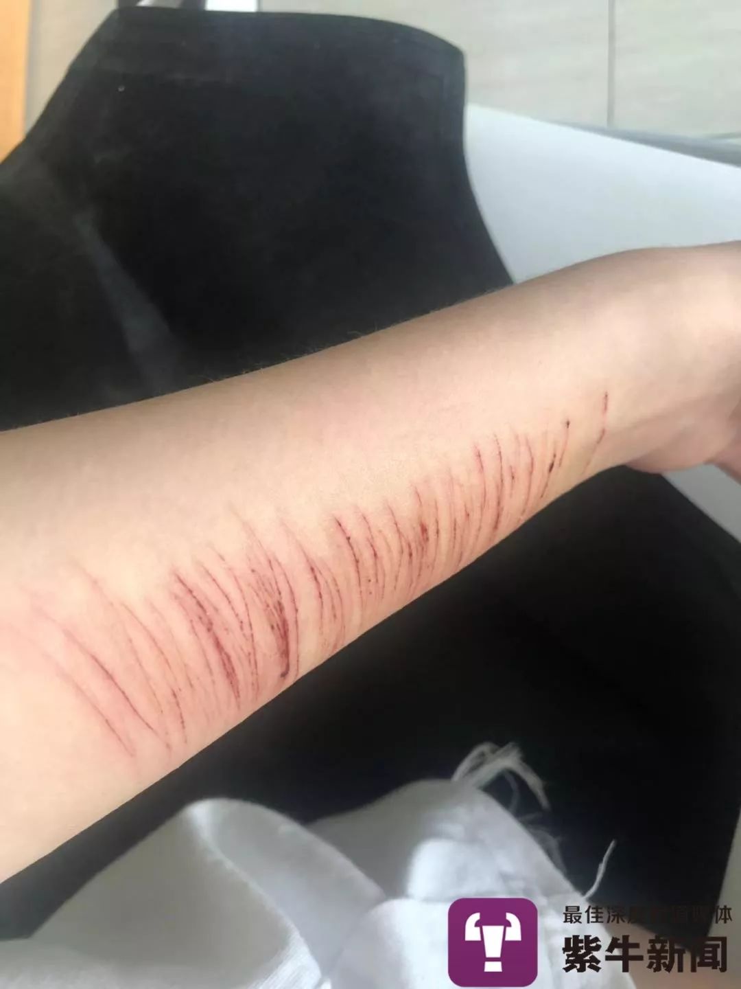 小婷