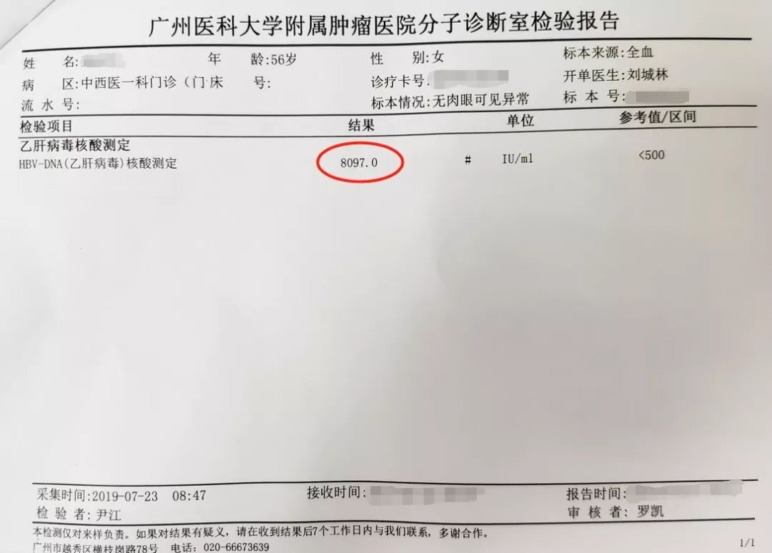 刘城林教授治乙肝3个月后病毒含量降至万分之一