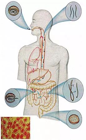 听过辟谷减肥生酮减肥但你听过蛔虫减肥吗