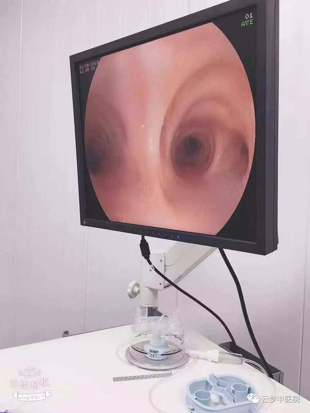 带你了解支气管镜