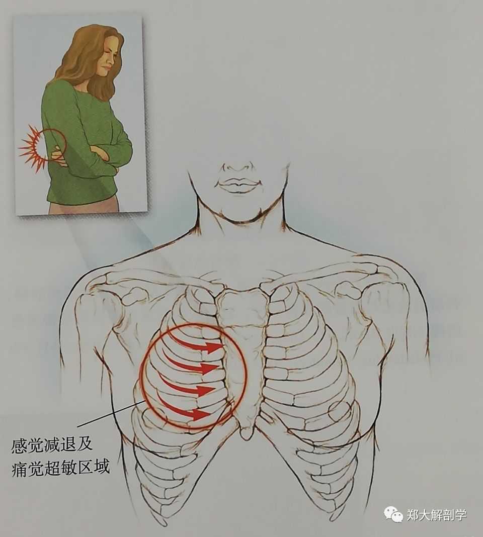 女性肋间神经痛位置图片