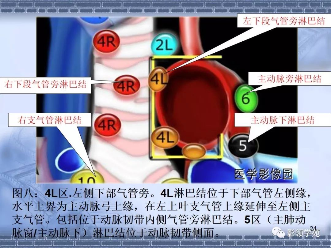 肺癌縱隔淋巴結分區