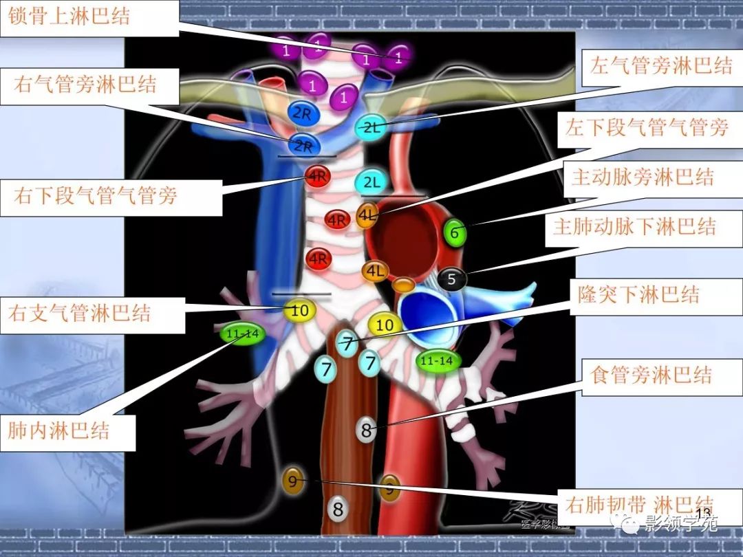 肺淋巴结分组图谱图片