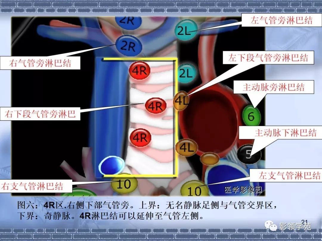 肺癌縱隔淋巴結分區