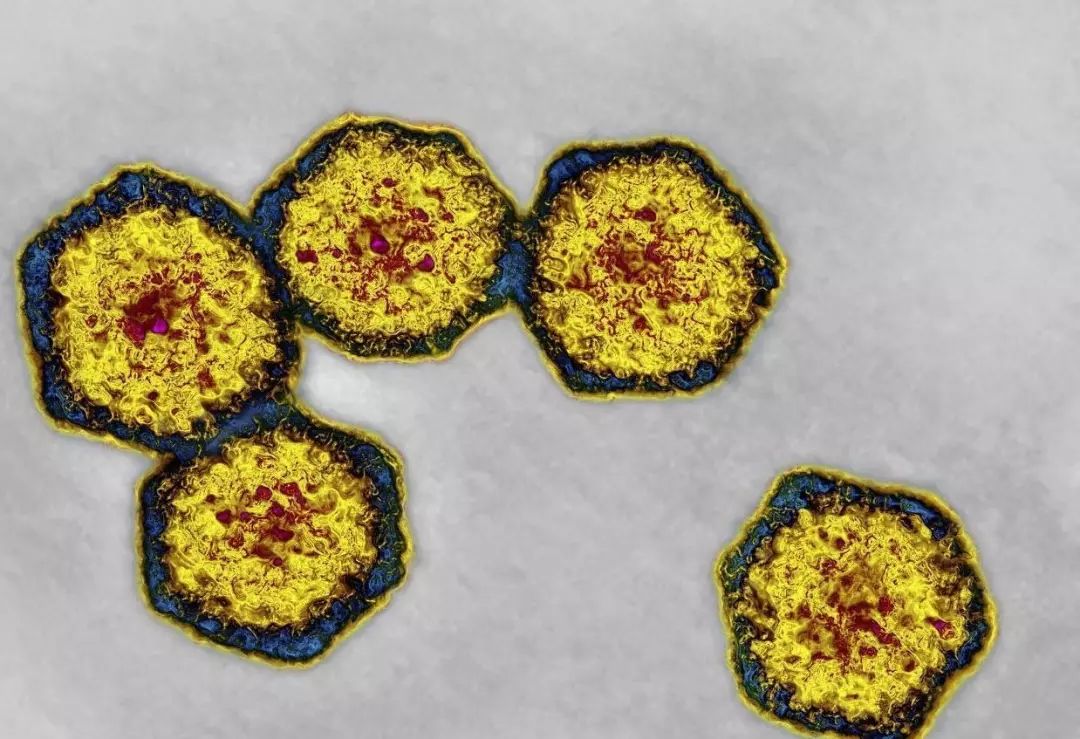 其原因是上海居民喜生食毛蚶,而毛蚶容易被甲肝病毒污染.