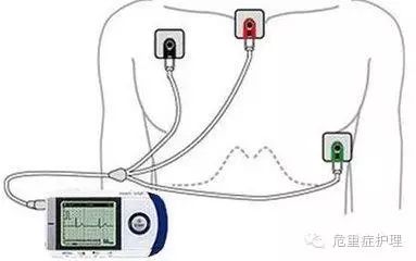 这起死亡病例教训惨痛,医护的忠告一定要听!