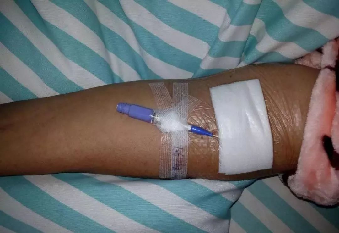 picc置管后最容易出现的8个问题你都会处理吗